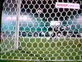 foot pes buts