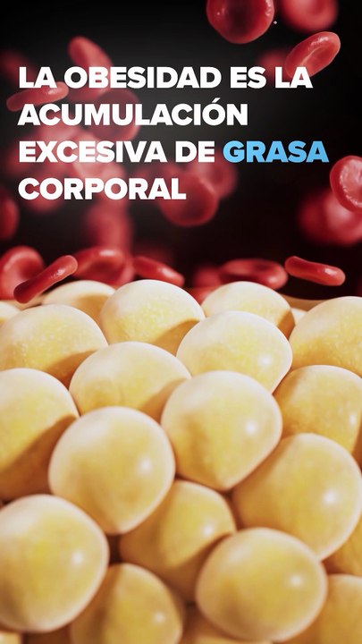 Atender la obesidad es fundamental para prevenir enfermedades crónicas