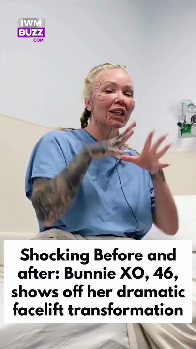 Hollywood news: Jelly Roll’s wife Bunnie Xo, 46,  surprises fans with her dramatic new look after a facelift