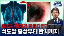 [메디컬 인사이트 128회] 외과의사가 본 '식도암의 증상과 치료법' / YTN
