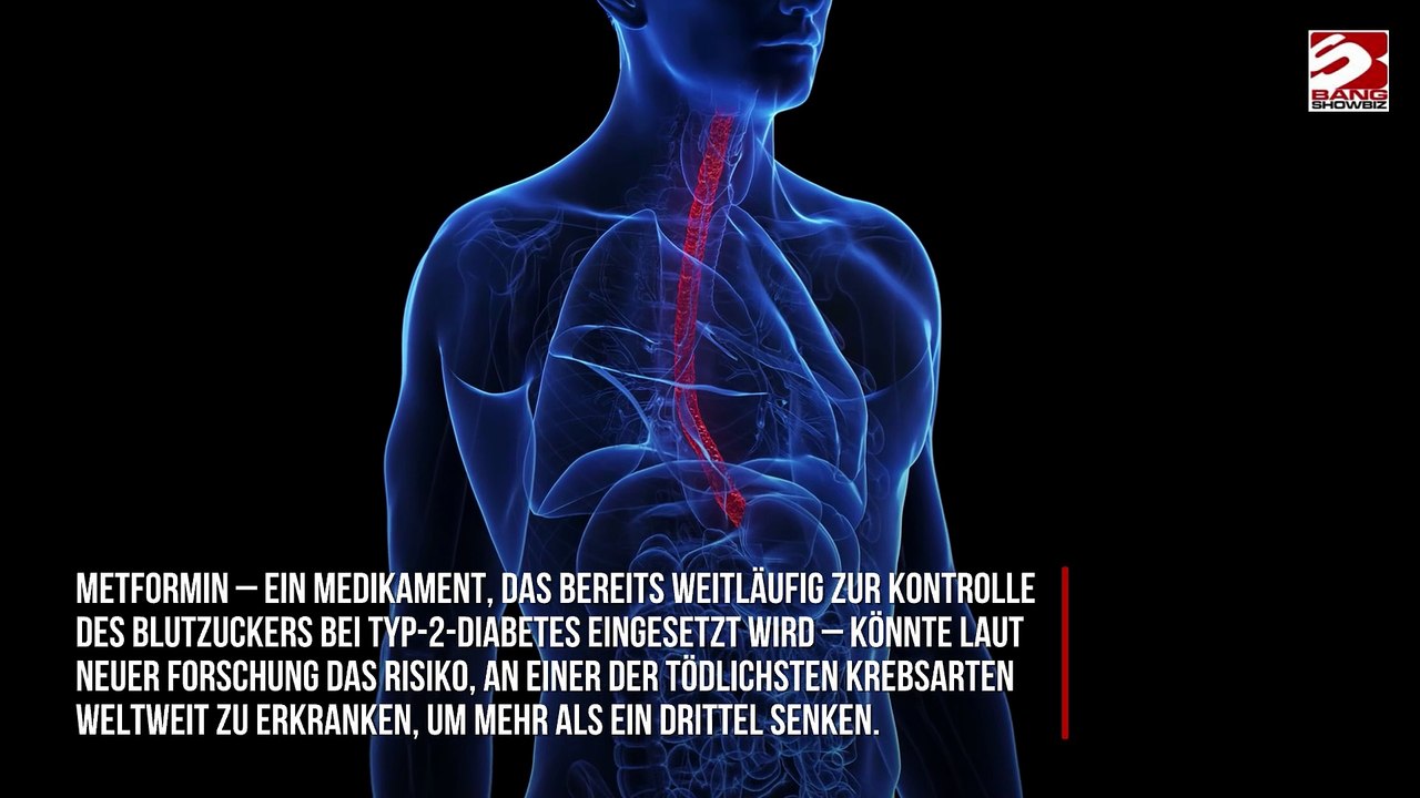 Diabetes-Medikament könnte Risiko für Speiseröhrenkrebs deutlich senken