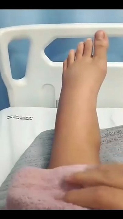 Menina de 11 anos é picada por cobra em balneário de Altônia e passa bem
