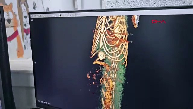 Sürekli kusan kedinin midesinden çıkan cisim şaşırttı! 4 yıl sonra fark edildi