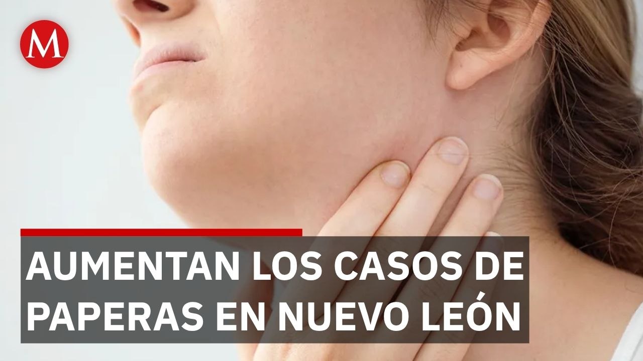 Nuevo León se mantienen entre las entidades con más casos de paperas a nivel nacional