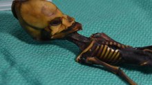 This Weird Skeleton Is Definitely Not An Alien