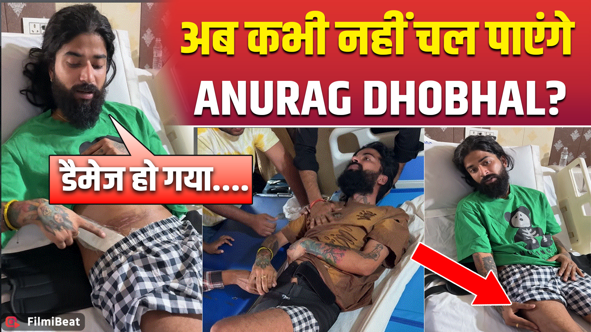 UK07 Heath Update: Anurag Dobhal का दाहिना पैर हुआ Damage, Fans ने बढ़ाई हिम्मत! FilmiBeat