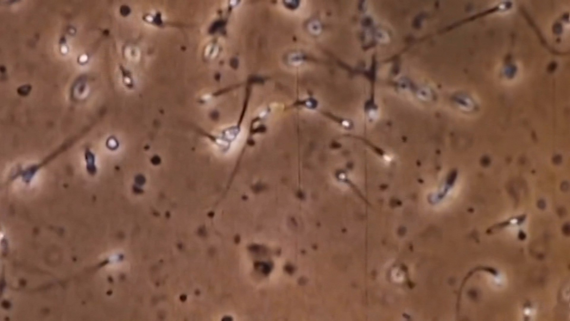 La ciencia recomienda una eyaculación diaria para evitar el daño genético de los espermatozoides