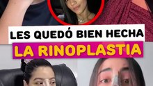 Famosas que les quedó bien hecha la rinoplastia