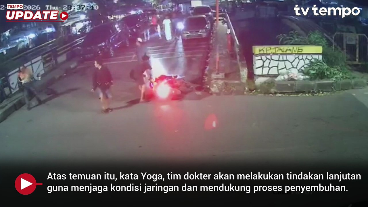 Kondisi Terkini Mata Kanan Andrie Yunus usai Disiram Air Keras