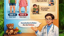 Kaki berbebtuk X dan O apakah normal atau perlu di periksa ke Dokter