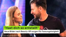 Laura Müller: "Hast dich so entstellt" - neue Bilder nach Beauty-OP sorgen für Fassungslosigkeit