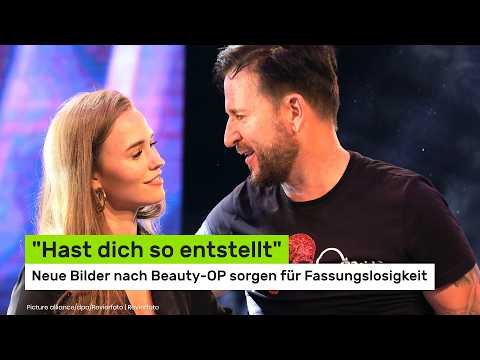 Laura Müller: Hast dich so entstellt - neue Bilder nach Beauty-OP sorgen für Fassungslosigkeit