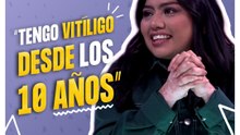 La Bea habla de su vitíligo y cómo convirtió el hate en comedia