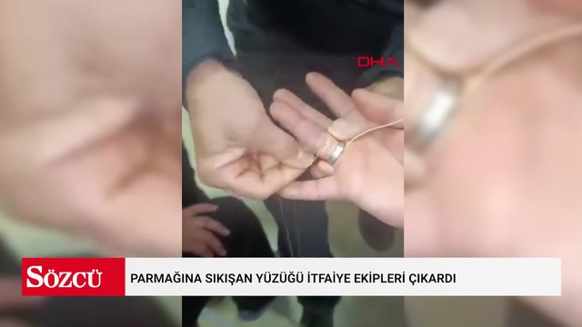 Parmağına sıkışan yüzüğü itfaiye ekipleri çıkardı