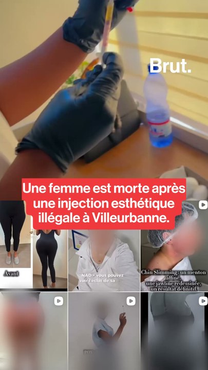 Une femme est morte après une injection esthétique illégale à Villeurbanne. L'influenceuse soupçonnée d’avoir réalisé l’acte a été mise en examen et placée en détention.
