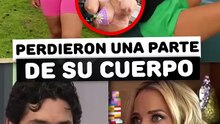 Famosos que perdieron una parte importante de su cuerpo