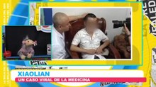 Injertan nariz en su frente por este raro motivo