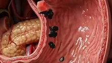 swallowed watermelon seeds_ here’s what happens inside your body #Shorts #Science #HumanBody