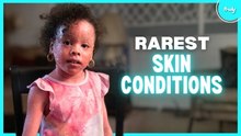The Most Extreme Skin Conditions In The World | BORN DIFFERENT