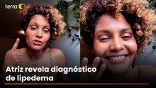 Bárbara Reis relata sinais ignorados por anos até descobrir lipedema: 'Achei que o problema era eu'