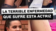 La terrible enfermedad que sufre esta actriz