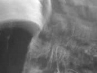 MOV00008