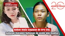 Babae mula Cagayan de Oro City, nabulag matapos buhusan ng asido ang mukha | Kapuso Mo, Jessica Soho