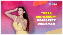 ¡IRRECONOCIBLE A RENACER! Dorismar reaparece y sorprende con su impactante transformación
