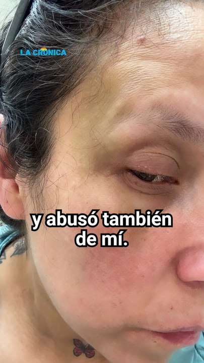 “Fingí estar muerta para poder escapar”: mujer denuncia intento de feminicidio