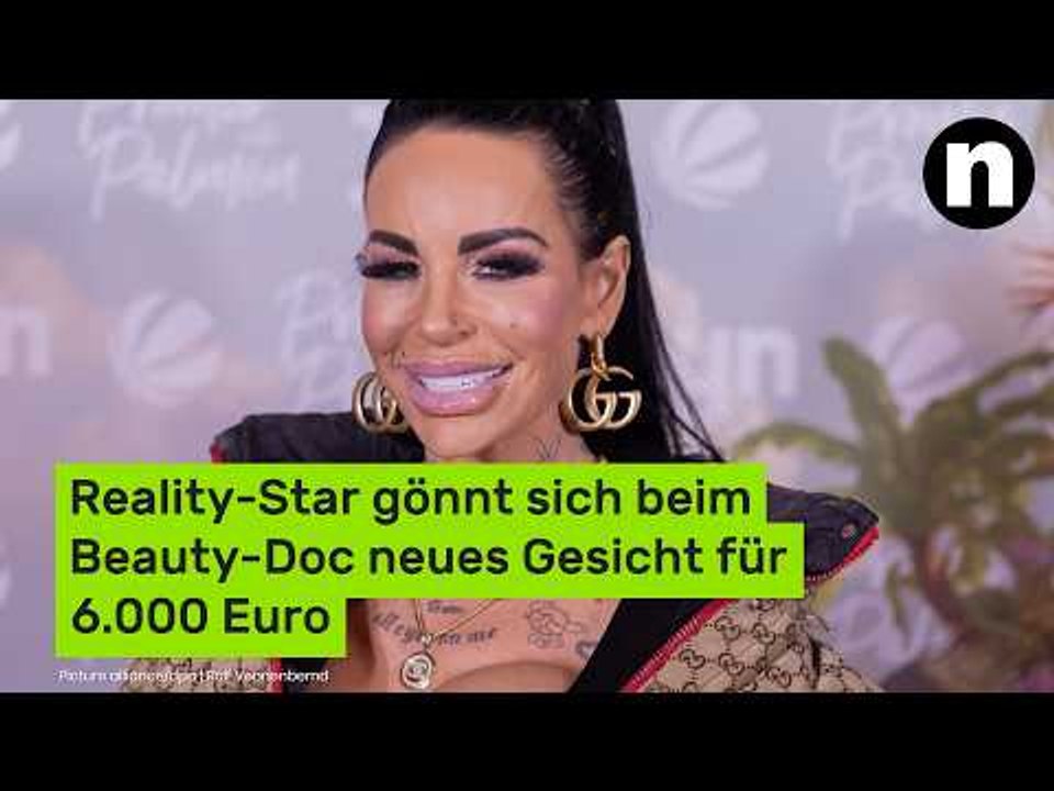 Gina-Lisa Lohfink: Reality-Star gönnt sich beim Beauty-Doc neues Gesicht für 6.000 Euro