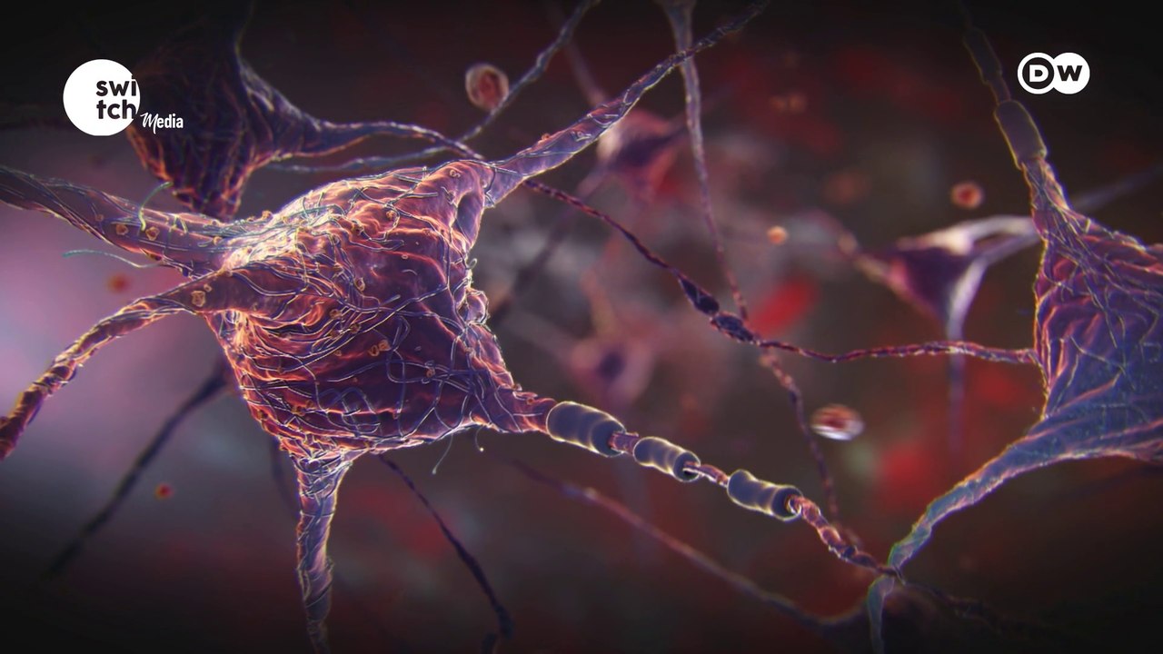 Mental health: Ill or just wired differently? - DW's In Good Shape