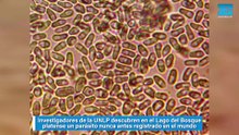 Investigadores de la UNLP descubren en el Lago del Bosque platense un parásito nunca antes registrado en el mundo