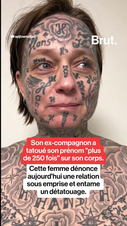 Son ex-compagnon a tatoué son prénom "plus de 250 fois" sur son corps, cette femme dénonce aujourd'hui une relation sous emprise et entame un détatouage.