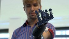 Así es la prótesis E-Redi: biónica, sencilla y fácil de usar. ¿El futuro de gadgets biónicos?
