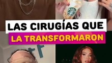 Las cirugías que transformaron a esta tiktoker en una mujer