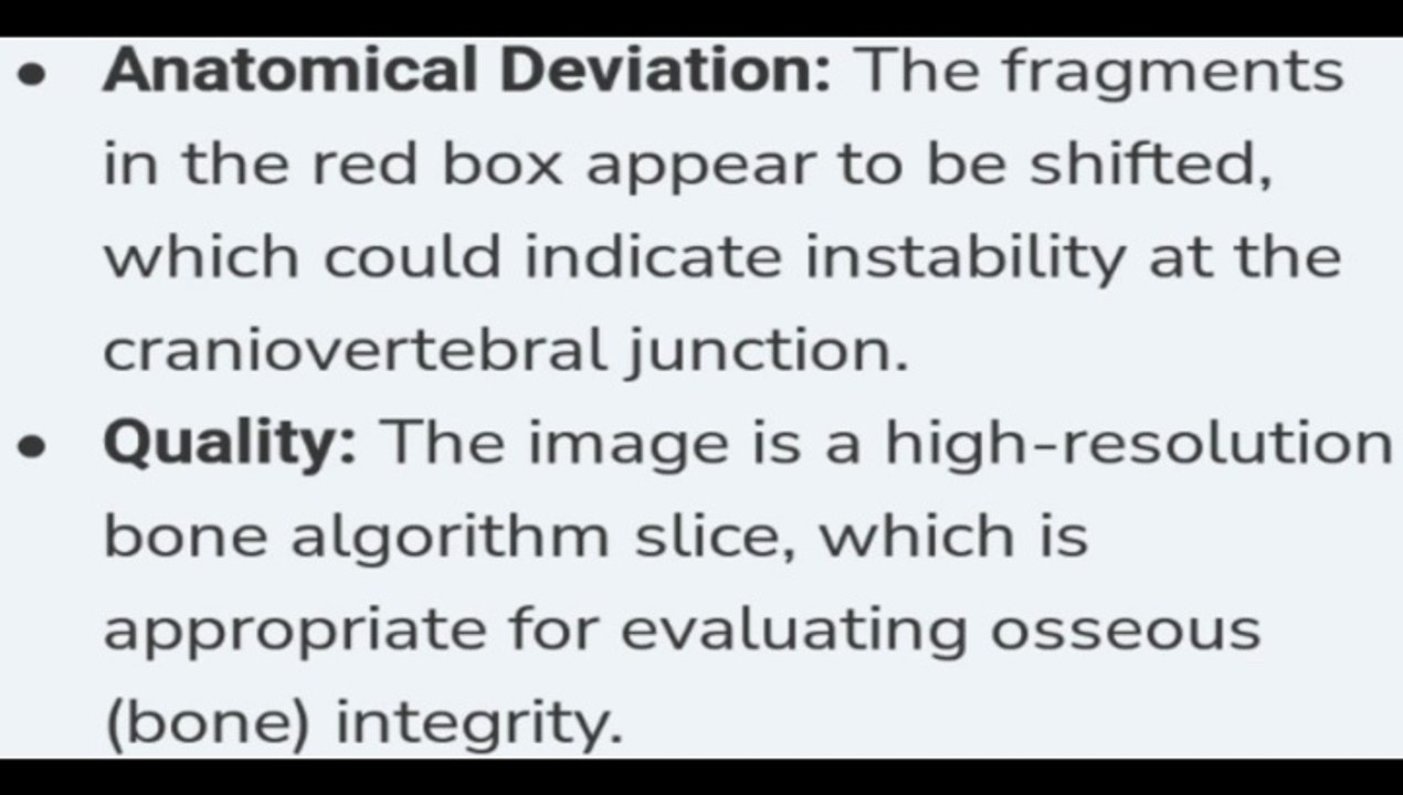 New Head CT Review (Bone Fracture) Contradicts OrthoAlabama / Perry Savage's "Quality" Dismissal