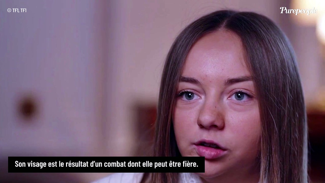 "Ils disent que c’est mieux pour moi" : Ce que la production de The Voice Kids a mis en place pour protéger Charlotte