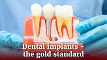 Dental implants, the gold standard at Esteem Dental Clinic