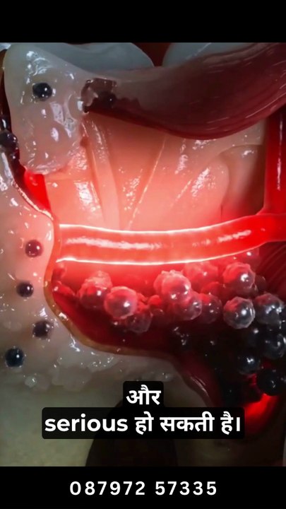 Best Dental Clinic in Jamshedpur | Braces & Implant Treatment | Advance Dental Care & Implant Center