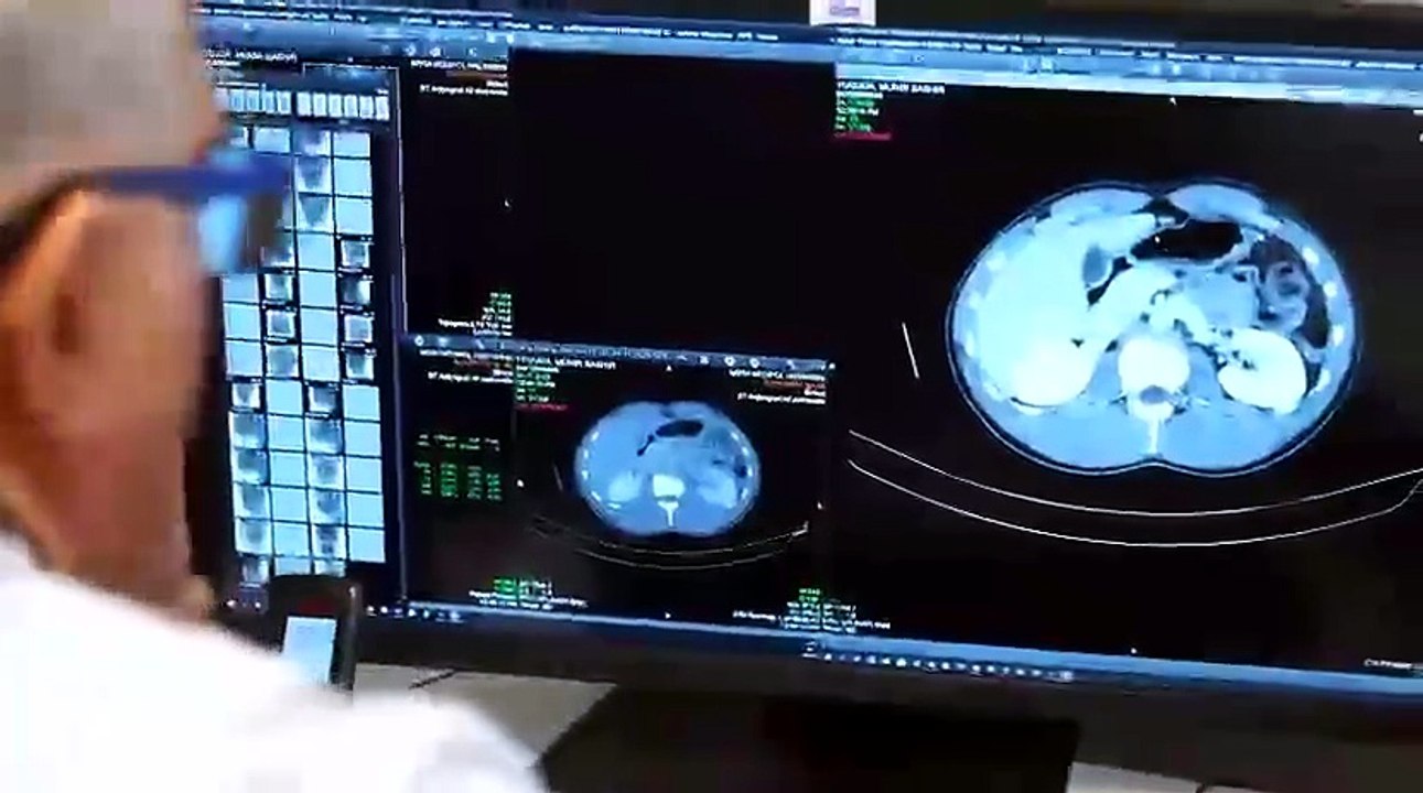 Ameliyatı 10 saat sürdü, bacak kemiğinden yeniden çene yapıldı