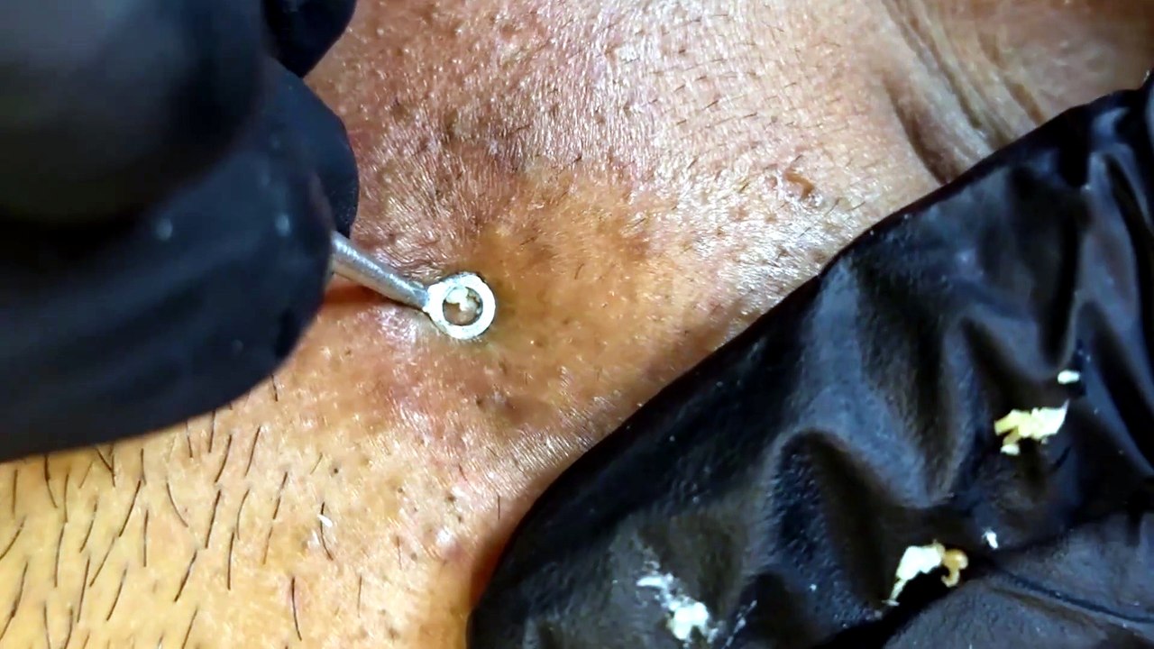 Skincare satisfying #1013