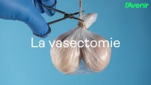 Santé/la vasectomie
