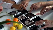 Ultrasound_Stock_Footage_-_Ultrasound_Free_Stock_Videos_-_Ultrasound_