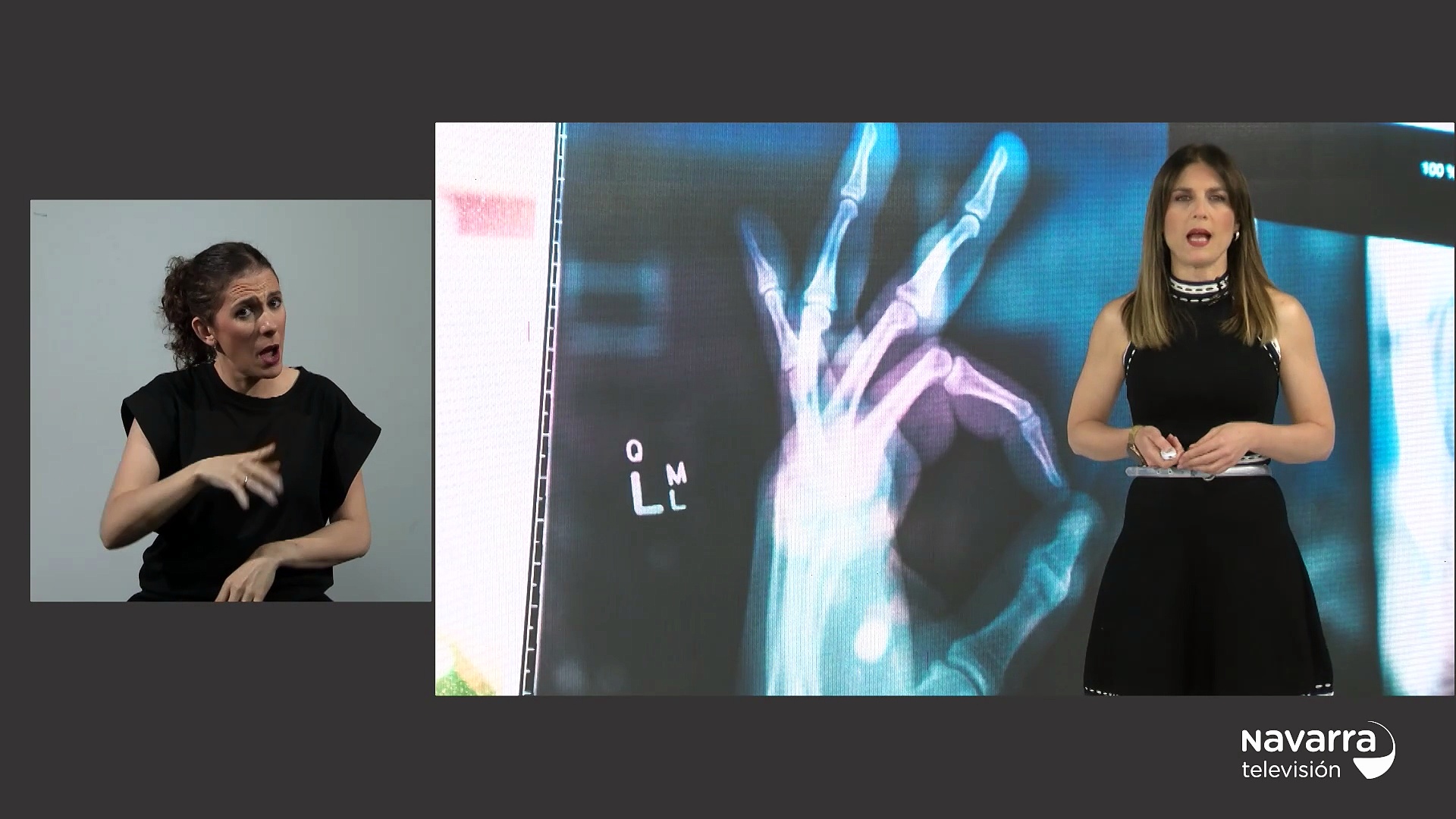 Noticias de Navarra 14.30h 17/04/2026 Lengua de Signos