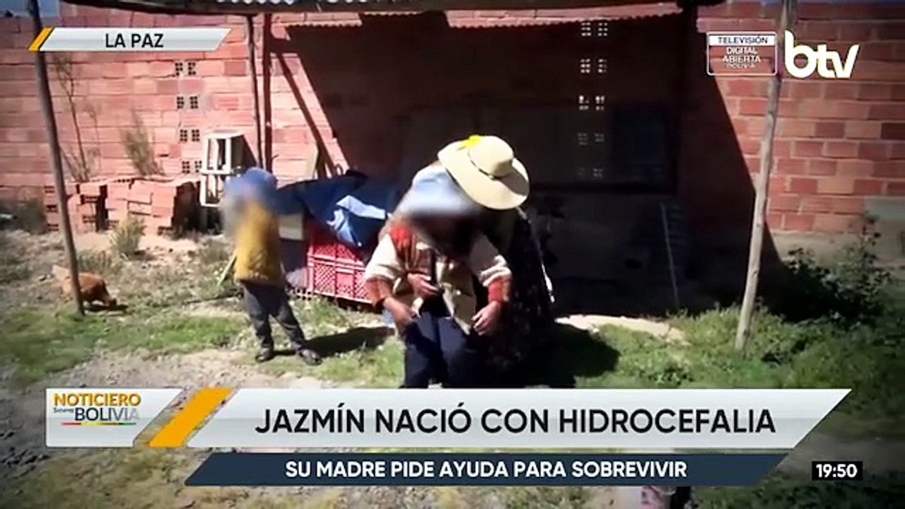 Jazmín necesita ayuda: Nació con hidrocefalia y su familia no cuenta con recursos para atenderla