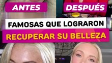 Famosas que recuperaron su belleza