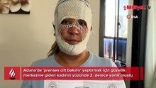 7 bin liralık ‘Prenses cilt bakımı’ kabusu: Oğlum beni görünce 'öcü' diyerek kaçtı