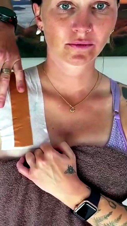 Tapping for shoulder dislocation