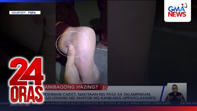 2 freshman cadet, nakitaan ng pasa sa talampakan; pinalo umano ng yantok ng kanilang upperclassmen | 24 Oras