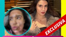 Patricia Valenzuela sobrevive a explosión de gas: “Me quemé la cara y el cuerpo”
